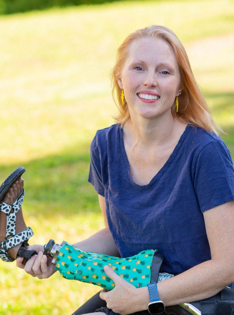 A white woman with Blonde hair wearing a blue t-shirt looks into the camera. She holds a prosthetic leg wearing a sandal.